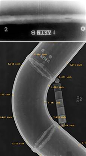 Radiographic Examinations